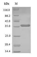 (Tris-Glycine gel) Discontinuous SDS-PAGE (reduced) with 5% enrichment gel and 15% separation gel.