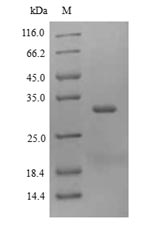 (Tris-Glycine gel) Discontinuous SDS-PAGE (reduced) with 5% enrichment gel and 15% separation gel.