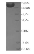 Recombinant Human Methionine synthase reductase (MTRR) – Figure 1 of 1