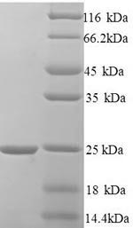 Recombinant Human Hematological and neurological expressed 1 protein (HN1) – Figure 1 of 1