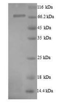 Recombinant Human Protein-arginine deiminase type-1 (PADI1) – Figure 1 of 1