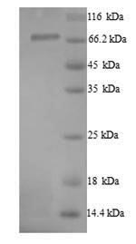 Recombinant Human Protein-arginine deiminase type-1 (PADI1) – Figure 1 of 1
