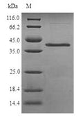 (Tris-Glycine gel) Discontinuous SDS-PAGE (reduced) with 5% enrichment gel and 15% separation gel.