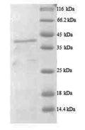 Recombinant Human A disintegrin and metalloproteinase with thrombospondin motifs 7 (ADAMTS7), partial – Figure 1 of 1