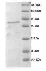 Recombinant Human A disintegrin and metalloproteinase with thrombospondin motifs 7 (ADAMTS7), partial – Figure 1 of 1