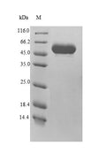 Recombinant human Multiple inositol polyphosphate phosphatase 1 (MINPP1) – Figure 1 of 1