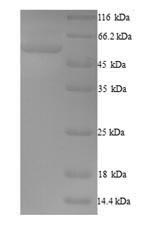 Recombinant Human F-box only protein 3 (FBXO3) – Figure 1 of 1
