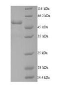 Recombinant Human Dynactin subunit 4 (DCTN4) – Figure 1 of 1