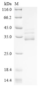 (Tris-Glycine gel) Discontinuous SDS-PAGE (reduced) with 5% enrichment gel and 15% separation gel.