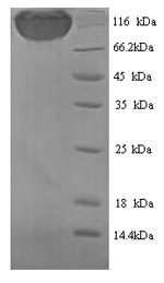 Recombinant Rat Podocalyxin (Podxl), partial – Figure 1 of 1