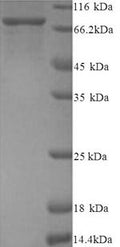Recombinant Human Protein-arginine deiminase type-2 (PADI2) – Figure 1 of 1