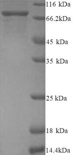 Recombinant Human Protein-arginine deiminase type-2 (PADI2) – Figure 1 of 1