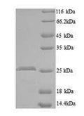 Recombinant Mouse CCN family member 5 (Ccn5) – Figure 1 of 1