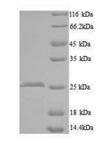Recombinant Mouse CCN family member 5 (Ccn5) – Figure 1 of 1