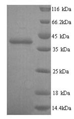 Recombinant Human Talin-2 (TLN2), partial – Figure 1 of 1
