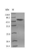 Recombinant Human Receptor-interacting serine/threonine-protein kinase 3 (RIPK3) – Figure 1 of 1