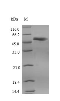 Recombinant Human Receptor-interacting serine/threonine-protein kinase 3 (RIPK3) – Figure 1 of 1