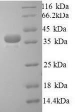 Recombinant Human Talin-1 (TLN1), partial – Figure 1 of 1