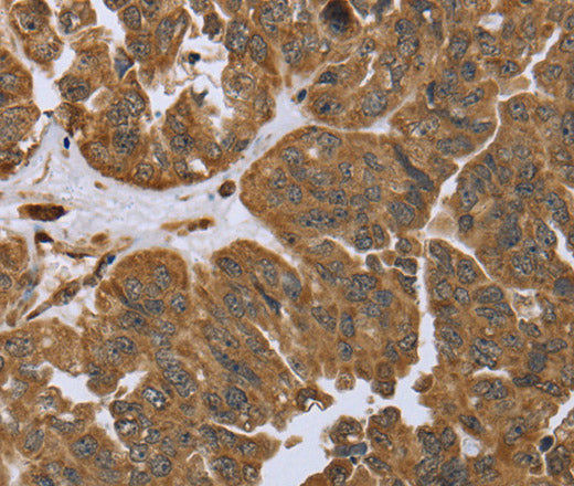 IKBIP Polyclonal Antibody – Figure 1 of 3