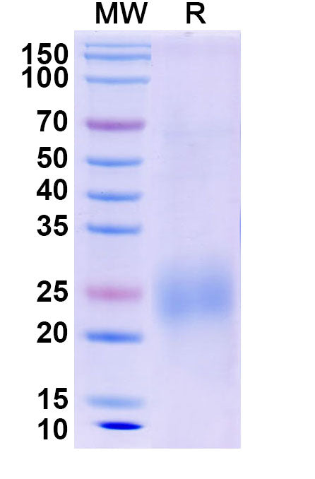 Recombinant Dog IL31 Protein, C-His
