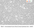 Immortalized Human Renal Cortical Epithelial Cells - SV40Tt | Applied Biological Materials (abm)