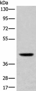 USP12 Polyclonal Antibody – Figure 1 of 3