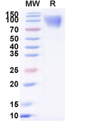 Recombinant Dog CD117/KIT Protein, C-His