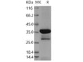 Recombinant Human DCX Protein (aa 45-150, GST Tag) – Figure 1 of 2