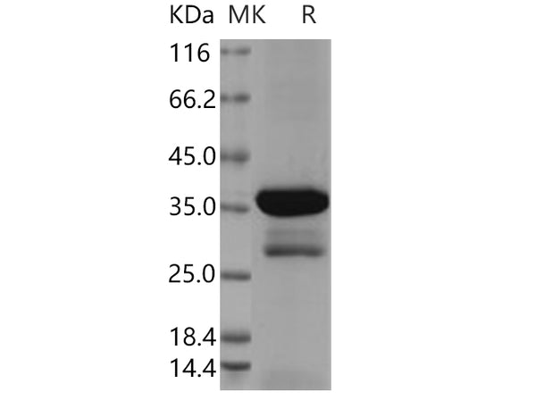 Recombinant Human DCX Protein (aa 45-150, GST Tag) – Figure 1 of 2