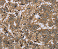 IKBIP Polyclonal Antibody – Figure 1 of 3