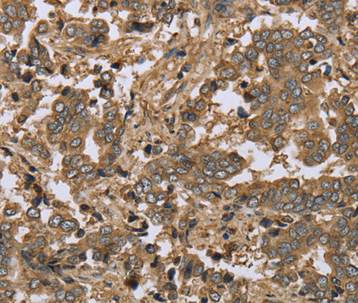 IKBIP Polyclonal Antibody – Figure 1 of 3