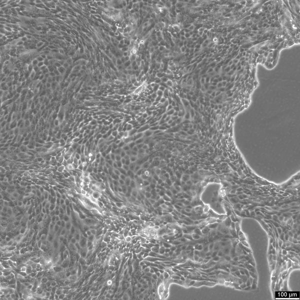 Calu-3 cell