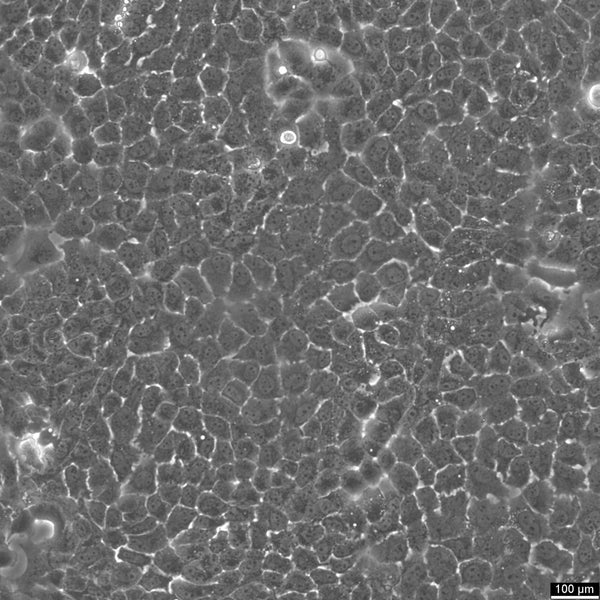 Caov-3 cell