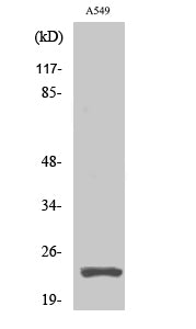 Cleaved-PARP1 (D214) Polyclonal Antibody – Figure 1 of 4