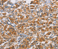 RICTOR Polyclonal Antibody – Figure 1 of 3