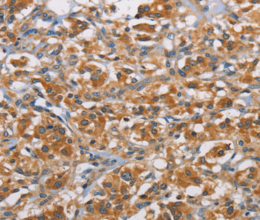 RICTOR Polyclonal Antibody – Figure 1 of 3