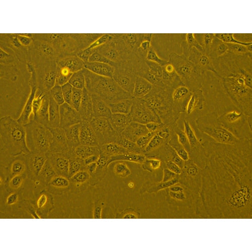 Human Primary Diabetic Liver Epithelial Cells – Figure 1 of 1