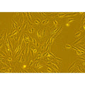 Human Primary Diabetic Gallbladder Epithelial Cells – Figure 1 of 1