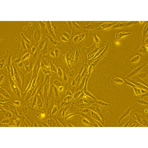 Human Primary Diabetic Gallbladder Epithelial Cells – Figure 1 of 1