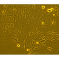Human Lung Tumor Epithelial Cells - Adenocarcinoma – Figure 1 of 1