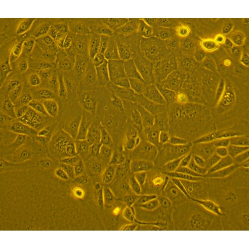 Human Lung Tumor Epithelial Cells - Adenocarcinoma – Figure 1 of 1