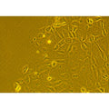 Human Lung Tumor Epithelial Cells - Squamous Cell Carcinoma – Figure 1 of 1