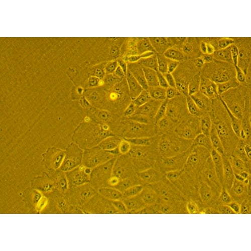 Human Lung Tumor Epithelial Cells - Squamous Cell Carcinoma – Figure 1 of 1