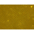 Human Breast Tumor Epithelial Cells – Figure 1 of 1