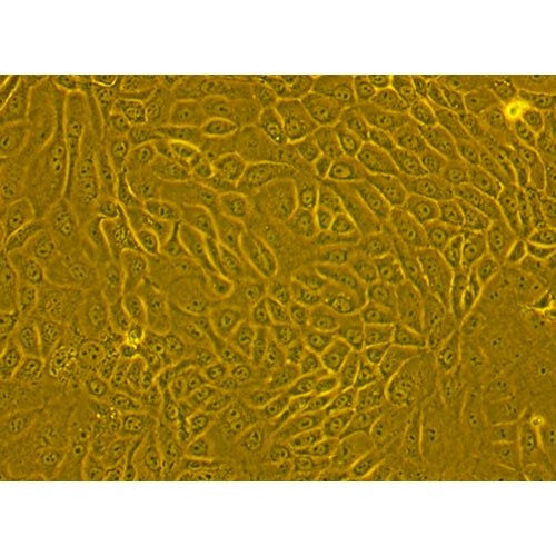 Human Primary Corneal Epithelial Cells – Figure 1 of 1