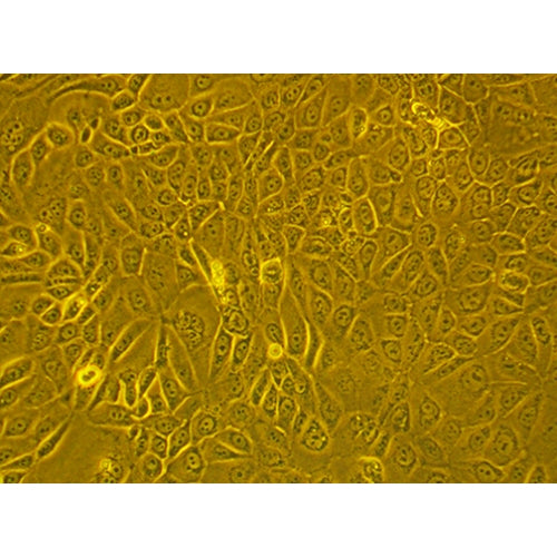 Human Ovarian Tumor Epithelial Cells – Figure 1 of 1