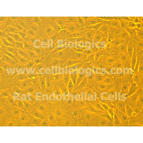 ZDF Rat Diabetic Retinal Microvascular Endothelial Cells – Figure 1 of 1