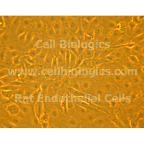 ZDF Rat Diabetic Small Intestinal Microvascular Endothelial Cells – Figure 1 of 1