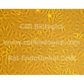 Human Primary Diabetic Gallbladder Endothelial Cells – Figure 1 of 1