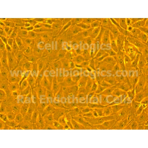 ZDF Rat Diabetic Kidney Glomerular Endothelial Cells – Figure 1 of 1